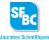 sfbc
